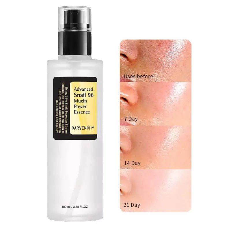 COSRX Advanced Snail 96 Mucin Power Essence (100ml)